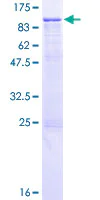 SDS-PAGE - Recombinant Human Integrin beta 7 protein (AB114397)