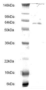 Recombinant Human Integrin linked ILK protein