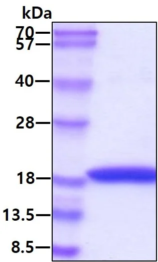 SDS-PAGE - Recombinant human Interferon alpha 1 protein (Active) (Tag Free) (AB48750)