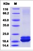 SDS-PAGE - Recombinant human Interferon alpha 1 protein (His tag) (AB276477)
