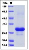 SDS-PAGE - Recombinant Human Interferon alpha 8 protein (His tag) (AB276257), expandable thumbnail