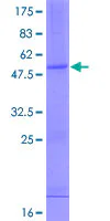 SDS-PAGE - Recombinant Human Interferon alpha10 protein (GST tag N-Terminus) (AB158734)