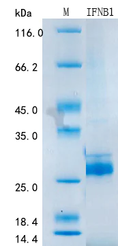 SDS-PAGE - Recombinant Human Interferon beta Protein Standard (10x His tag) (AB316396)
