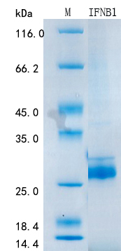 SDS-PAGE - Recombinant Human Interferon beta Protein Standard (His tag) (AB316396), expandable thumbnail