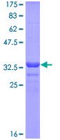 Recombinant Human intestinal alkaline phosphatase protein