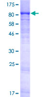 Recombinant Human Invadolysin protein