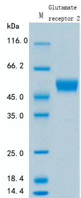 SDS-PAGE - Recombinant Human Ionotropic Glutamate receptor 2 Protein Standard (His tag) (AB317299)