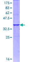 SDS-PAGE - Recombinant Human IP3 receptor protein (AB158779), expandable thumbnail