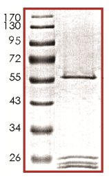 SDS-PAGE - Recombinant Human IPL-1/STK13/Aurora C protein (AB133139)