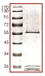 SDS-PAGE - Recombinant Human IPL-1/STK13/Aurora C protein (AB133139)