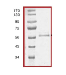 SDS-PAGE - Recombinant human IPL-1/STK13/Aurora C protein (AB63177)