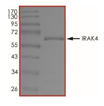 Recombinant human IRAK4 protein (Active)