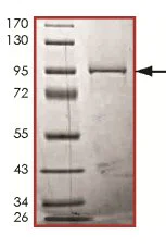 SDS-PAGE - Recombinant Human IRAKM protein (AB125546)