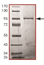 SDS-PAGE - Recombinant Human IRAKM protein (AB125546)