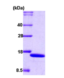 SDS-PAGE - Recombinant Human IRF2 protein (His tag N-Terminus) (AB59954)