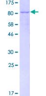 Recombinant Human IRF5 protein