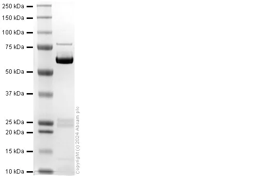 SDS-PAGE - Recombinant Human IRF5 Protein (His tag) (AB318948)