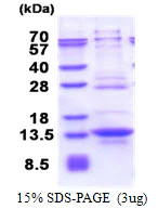 SDS-PAGE - Recombinant Human IRF5 protein (His tag N-Terminus) (AB177731)