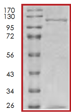 SDS-PAGE - Recombinant Human IRS1 protein (AB70538)