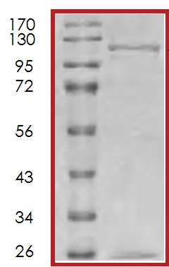 SDS-PAGE - Recombinant Human IRS1 protein (AB70538)