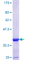 SDS-PAGE - Recombinant Human Isoleucyl tRNA synthetase protein (AB152465)