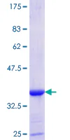 SDS-PAGE - Recombinant Human Isoleucyl tRNA synthetase protein (GST tag N-Terminus) (AB152465)