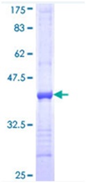 SDS-PAGE - Recombinant Human ITGA7 protein (GST tag N-Terminus) (AB114551)