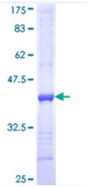 SDS-PAGE - Recombinant Human ITGA7 protein (GST tag N-Terminus) (AB114551)