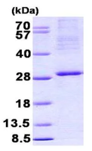 SDS-PAGE - Recombinant Human ITGB3BP protein (denatured) (His tag N-Terminus) (AB156338)