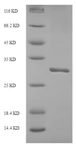 SDS-PAGE - Recombinant Human ITIH5 protein (Tagged) (AB238235)