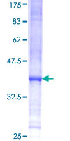 SDS-PAGE - Recombinant Human ITK/EMT protein (AB152482)