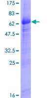 SDS-PAGE - Recombinant Human ITM2B protein (GST tag N-Terminus) (AB160492)