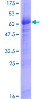 SDS-PAGE - Recombinant Human ITM2B protein (GST tag N-Terminus) (AB160492)
