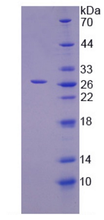 SDS-PAGE - Recombinant Human ITPA protein (Tagged) (AB275571)