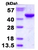 SDS-PAGE - Recombinant Human ITPK1 protein (His tag N-Terminus) (AB130021)