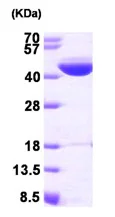 SDS-PAGE - Recombinant Human IVD protein (AB93747)