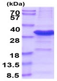 SDS-PAGE - Recombinant Human IYD protein (denatured) (AB177648), expandable thumbnail