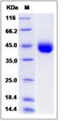 SDS-PAGE - Recombinant Human IZUMO1 protein (His tag) (AB276551)