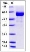 SDS-PAGE - Recombinant Human IZUMO4 protein (Fc Chimera) (AB276521)