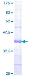 SDS-PAGE - Recombinant Human Jagged 2/JAG2 protein (AB114541)