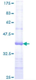 SDS-PAGE - Recombinant Human Jagged 2/JAG2 protein (AB114541)