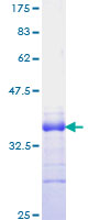 Recombinant Human Jagged1 protein