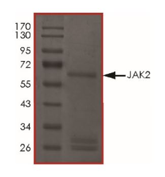 SDS-PAGE - Recombinant human JAK2 protein (Active) (AB268691), expandable thumbnail
