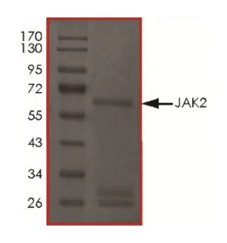 SDS-PAGE - Recombinant human JAK2 protein (Active) (AB268691)