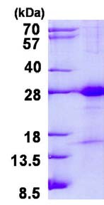 SDS-PAGE - Recombinant Human JAM-C protein (His tag N-Terminus) (AB134536)