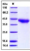 SDS-PAGE - Recombinant Human JAML protein (His tag) (AB276204)