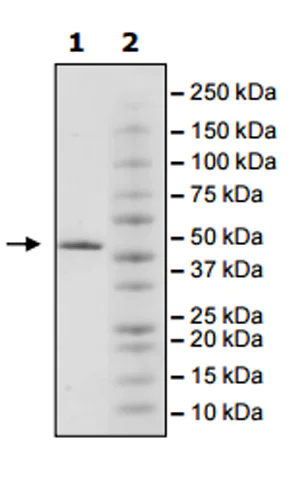 SDS-PAGE - Recombinant human JHDM1D protein (Active) (AB271568)