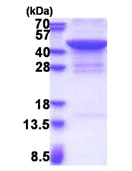 SDS-PAGE - Recombinant Human JMJD7 protein (His tag N-Terminus) (AB174553)