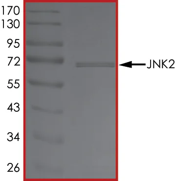 SDS-PAGE - Recombinant human JNK2 protein (AB119726)