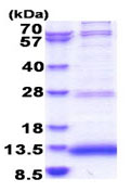 Recombinant Human JTB protein